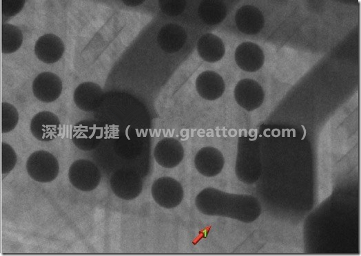 BGA因?yàn)楹笁|變小，造成錫膏過(guò)多而最終形成焊接短路的結(jié)果。